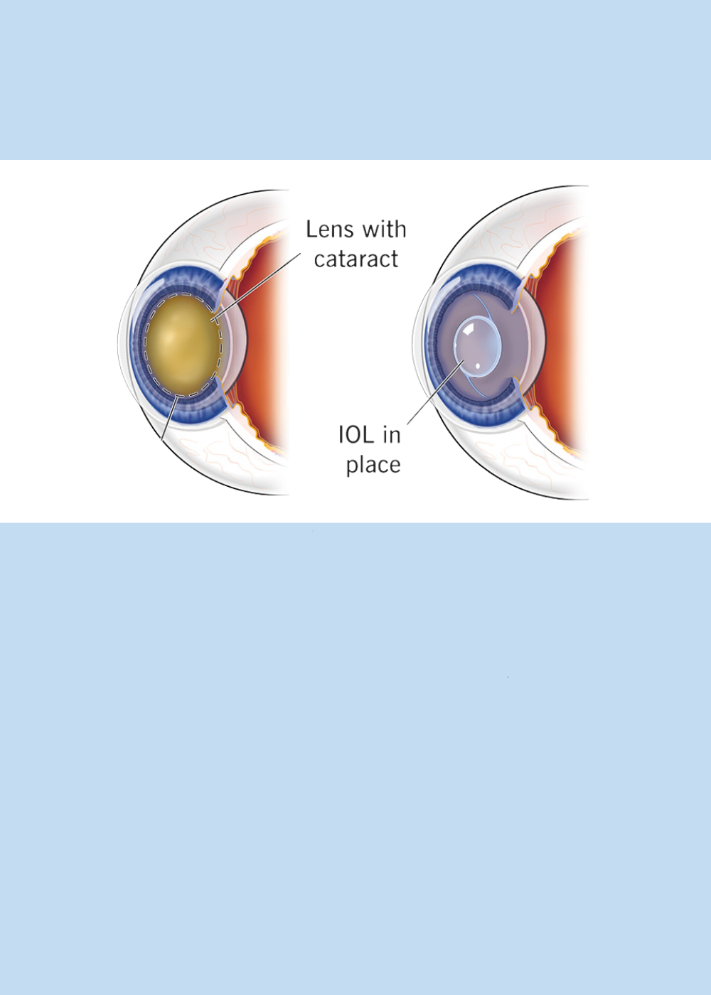 FMamta Netralaya Services